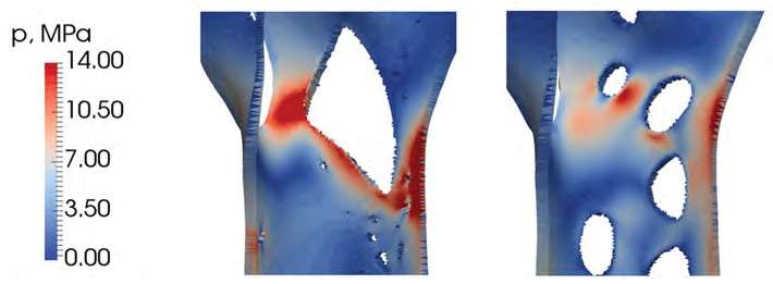 Topologically optimized 3D printed cast