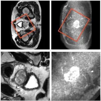 Easier processing of medical images through the use of HPC