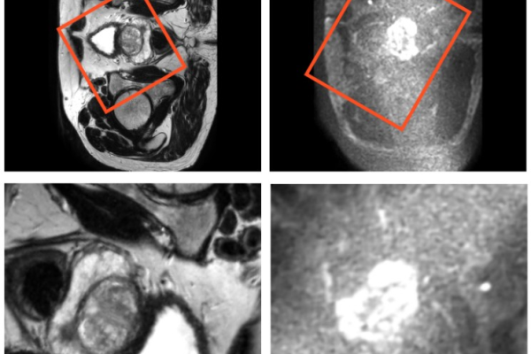 Easier processing of medical images through the use of HPC