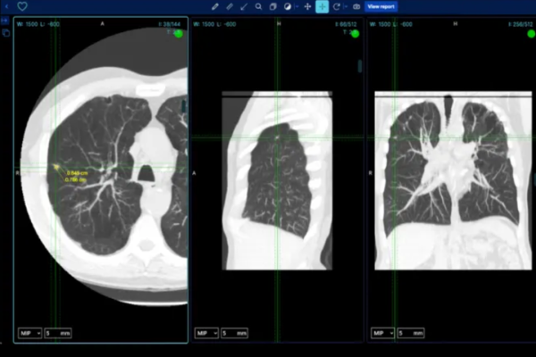 BMVision detects lesions across the whole body